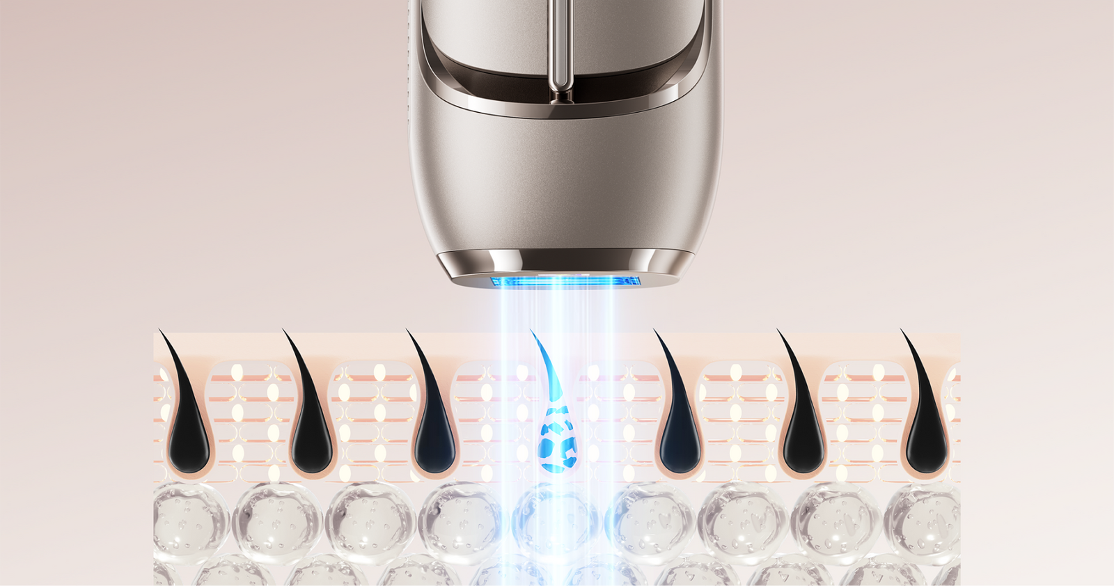 Technologie multi impulsions pour appareil d épilation IPL Dreame Nova énergie profonde